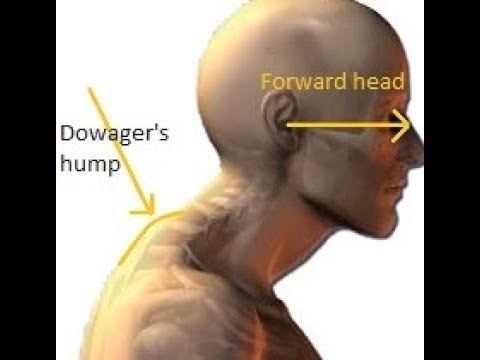How to prevent Neck and shoulder stiffness